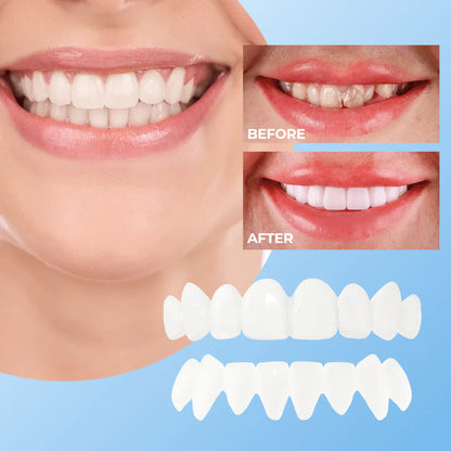 HappySmile™ - Stralend Witte Tanden In Een Handomdraai